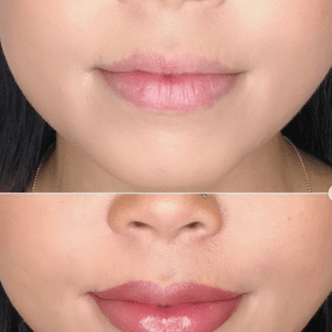 Side-by-side before and after lip liner and lip tint results showing improved definition and balance.