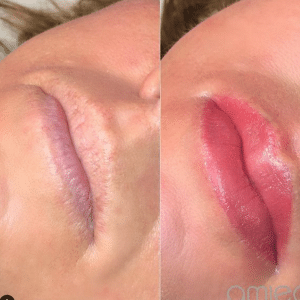 Before and after lip liner and lip tint results creating soft, natural color definition.