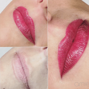 Before and after permanent lip liner and tint treatment with enhanced symmetry.