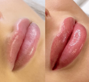 Before and after lip tint