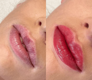 Before and after lip tint