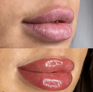 Before and after lip tint