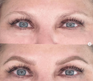 Before and after nano hair stroke treatment creating soft, natural-looking brows.